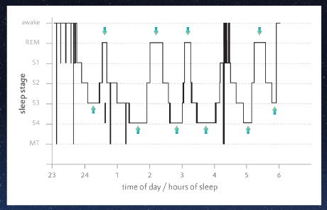 דורמינול לילה תורם לשיפור תבנית השינה: