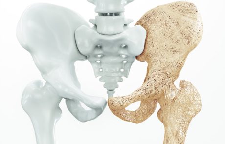 Hip fracture, mortality risk, and cause of death over two decades