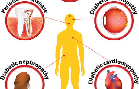 ליעילות הטיפול ב-ה-dapagliflozin (פורסיגה) במחלת כליות השלכות חיוביות בחולי אי ספיקת לב ( Medscape)
